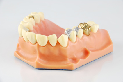 EURAdent Zahnersatz Patienten