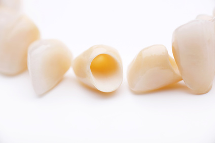 Zahnersatz / Zahnkrone aus Keramik